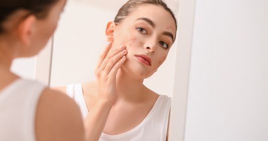 Why is pH-Balanced Skincare Important?